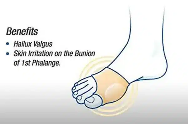 LP 350 HALLUXCARE BUNION SLEEVE MEDIUM 2 1